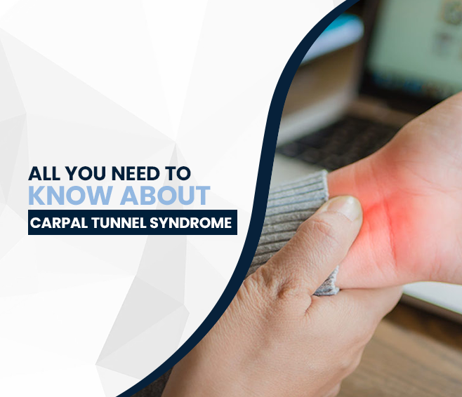 All You Need to Know About Carpal Tunnel Syndrome