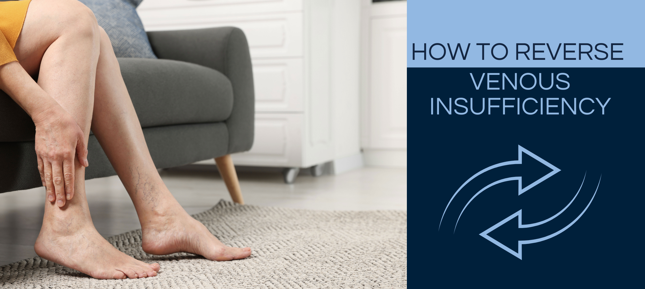 Reverse Venous Insufficiency