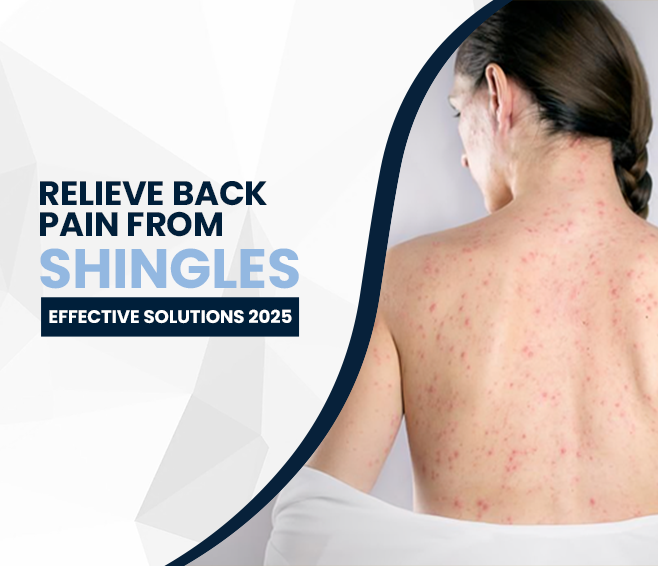 relieve back pain from shingles