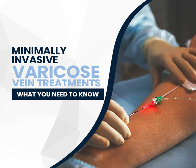 minimally invasive varicose vein treatments