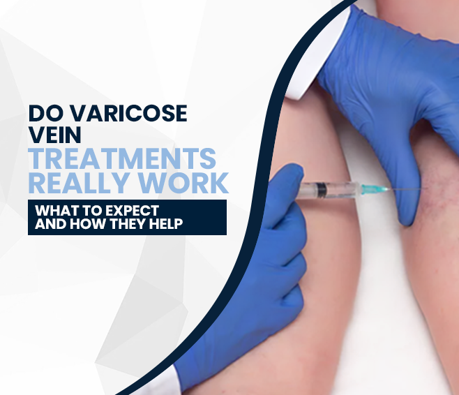 Do Varicose Vein Treatments Really Work