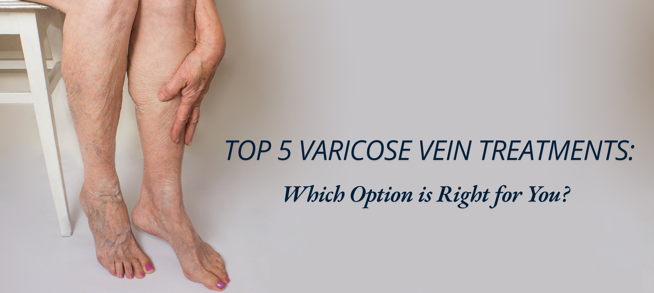 5 Varicose Vein Treatments