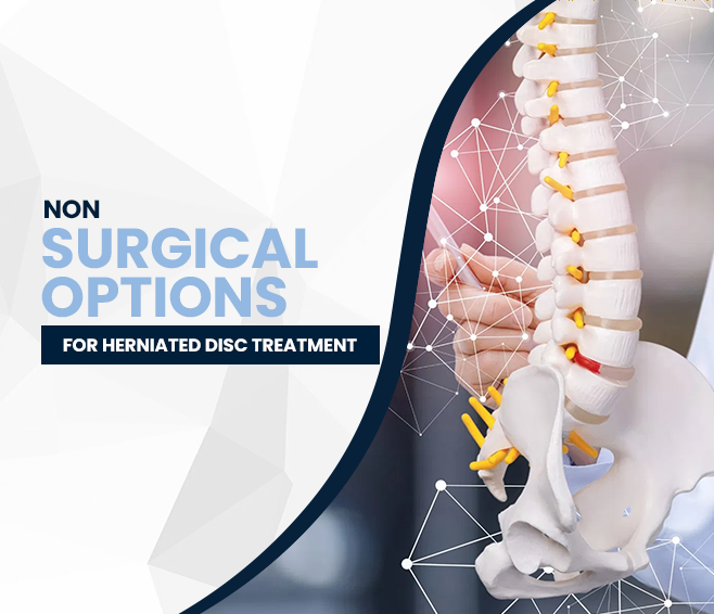 Non-Surgical Options for Herniated Disc Treatment