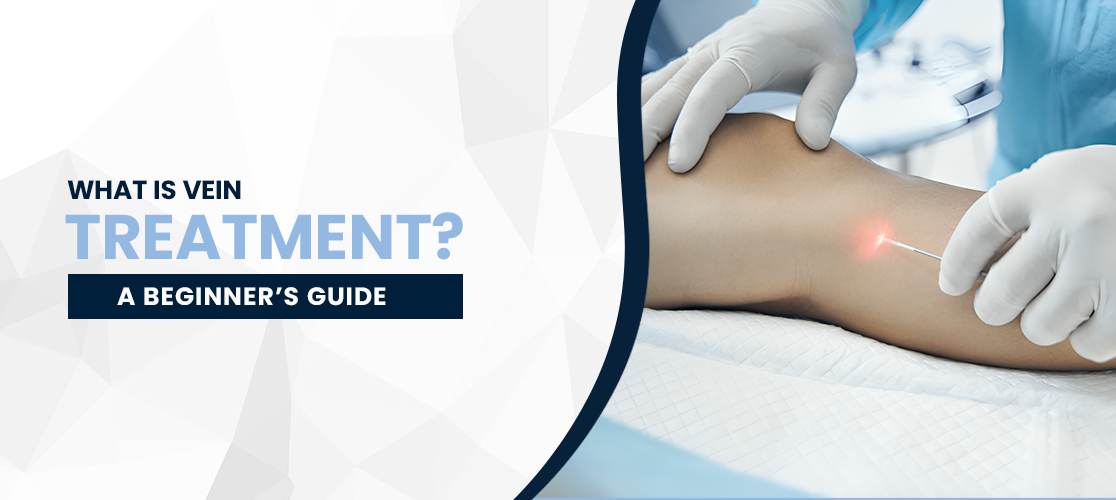 What Is Vein Treatment? A Beginner’s Guide